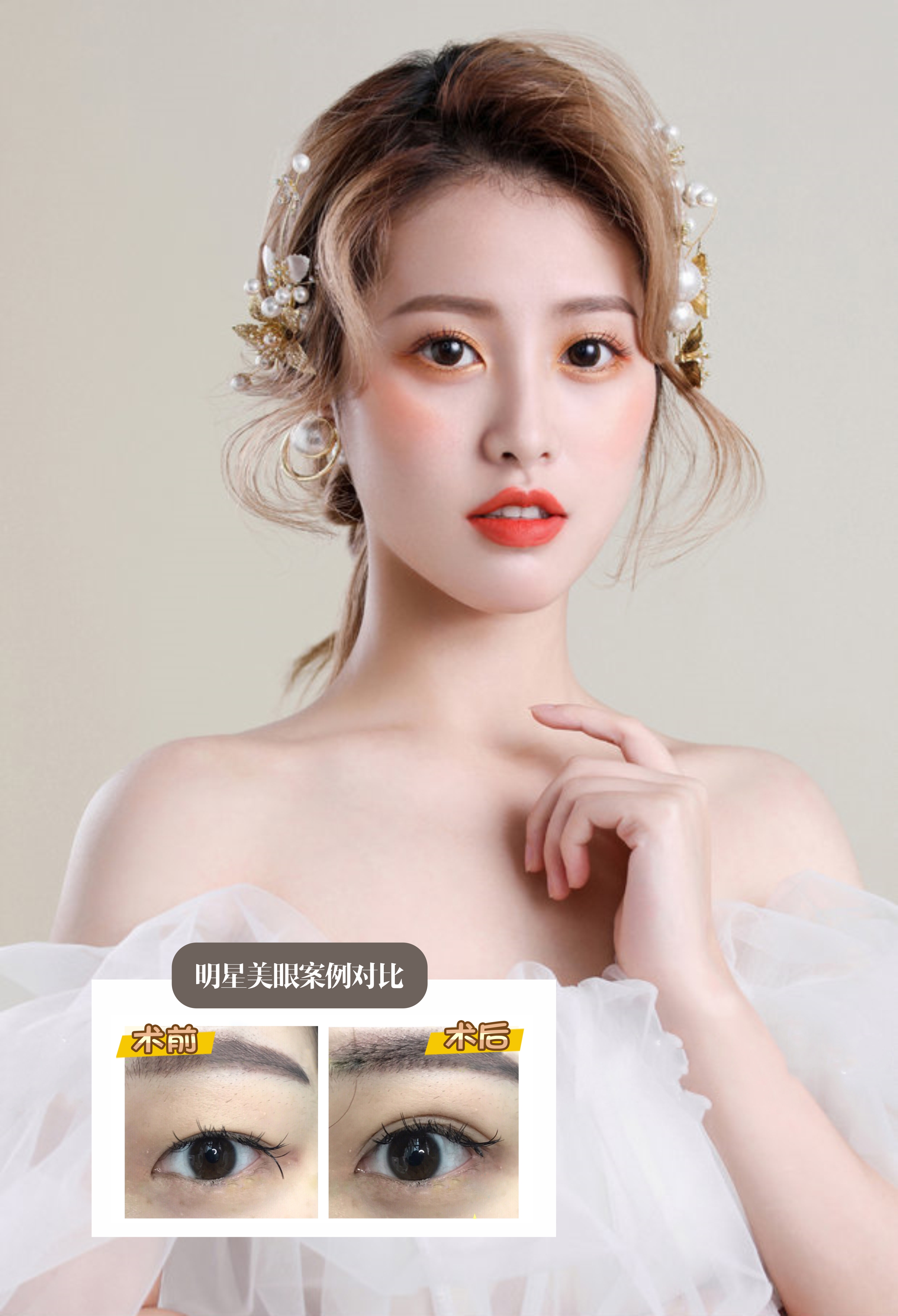 🔬 Laser điều trị sắc tố